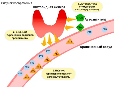 Экзофтальм - причины появления, симптомы заболевания, диагностика и способы  лечения