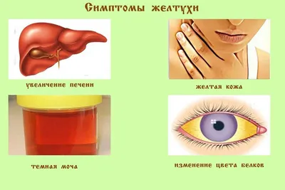 Рекомендации при появлении желтухи любой формы. | Дарув | Дзен