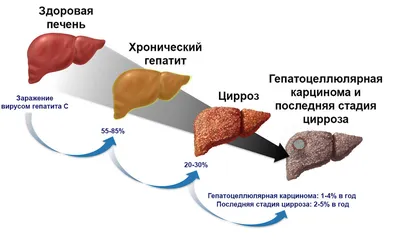 Гепатосил(капсулы при гепатите, циррозе) №30 (ID#988595839), цена: 189 ₴,  купить на Prom.ua