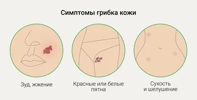 Что такое цветущий лишай и как от него избавиться — блог медицинского  центра ОН Клиник