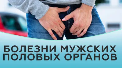 Хочу убрать белые прыщи на члене как это сделать | Урологический форум —  онлайн консультация, вопросы врачу уролог Смерницкому