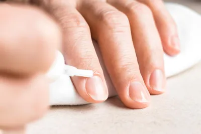 Белые пятна на ногтях: почему они появляются и можно ли избавиться от них  навсегда | MARIECLAIRE