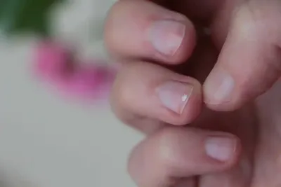 Почему появляются белые пятна на ногтях | Godzzilla.ru | Дзен