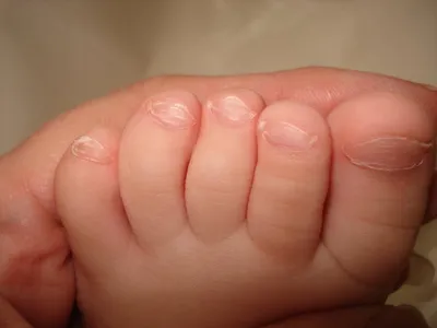 Белые пятна на ногтях: почему они появляются и можно ли избавиться от них  навсегда | MARIECLAIRE