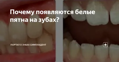 Белые пятна на передних зубах - Форум для стоматологов, зубных техников и  пациентов.
