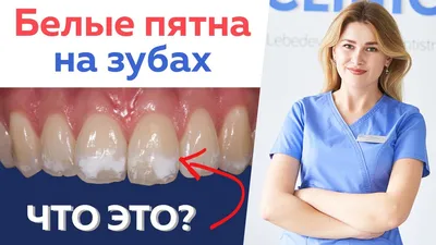 Почему на зубах появляются белые пятна? | Стоматология ROOTT | Дзен