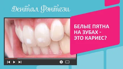 Белые пятна на зубах. Откуда берутся, что означают и как вылечить?