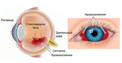 Белые Пятна Под Глазами В Фиолетовой Упаковке И Без Рисованная Акварельная  Иллюстрация Изолированные Объекты На Белом Фоне Для Украшени — стоковая  векторная графика и другие изображения на тему Без людей - iStock