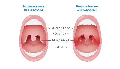 Боль в горле: о чем он может сигнализировать и когда обращаться к врачу |  Здоровье