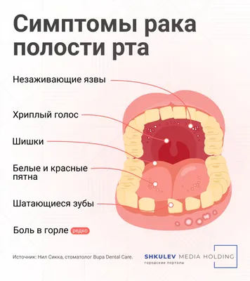 Врач перечислил основные симптомы рака ротовой полости: Уход за собой:  Забота о себе: Lenta.ru