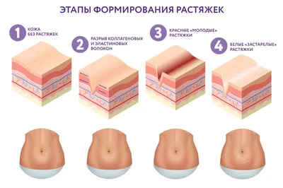 MI-Ri-NE Восковые полоски для лица, 16 шт + 2 салфетки