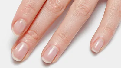 Белая полоса на ногте большого пальца ноги (66 фото)