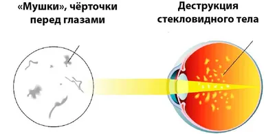 Четыре волшебные точки: самая простая и эффектная идея для новогоднего  макияжа