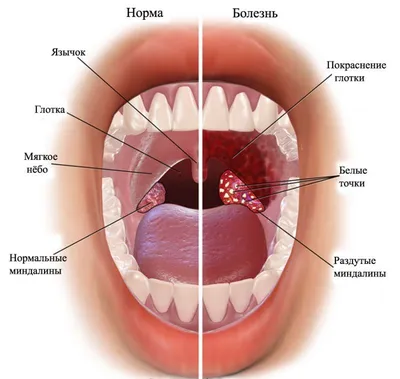 Pin em Здоровье