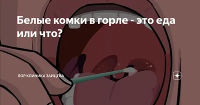 Белый налет на языке - что это значит и как от него избавиться? | Полезные  советы - блог стоматологической клиники Complex Dent в Киеве