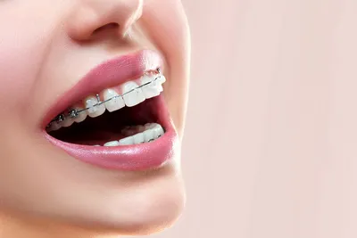 На губах белый налет по утрам: почему появляется, способы лечения | Dental  Art