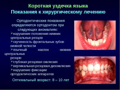 Стоматит – что это, как и чем лечить у взрослых, симптомы, причины