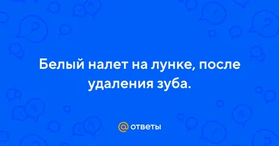 Стоматологія Максима Макаренка on Instagram: \"Что такое белый налет на  ранке после удаления зуба? ☑️Через несколько часов после удаления зуба в  лунке появляется темный сгусток — синеватого, черного, красного или бурого  оттенка.