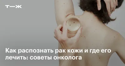 Опухоли кожи: памятка для косметологов | Портал 1nep.ru