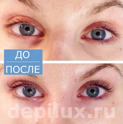 БИОЗАВИВКА, BOTOX LASHES, ЛАМИНИРОВАНИЕ РЕСНИЦ | ВКонтакте