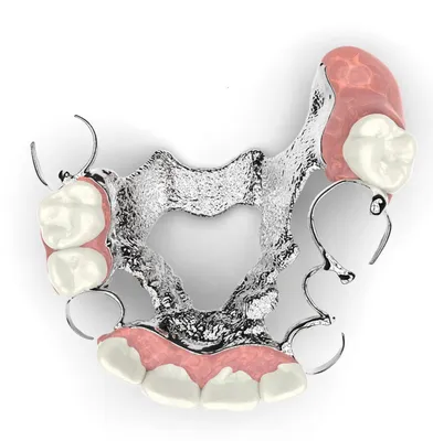 Частично съемный протез на нижнюю челюсть. Услуги установки частичного  съемного протеза на нижнюю челюсть. Установка частичного съемного протеза  на нижнюю челюсть в Москве.