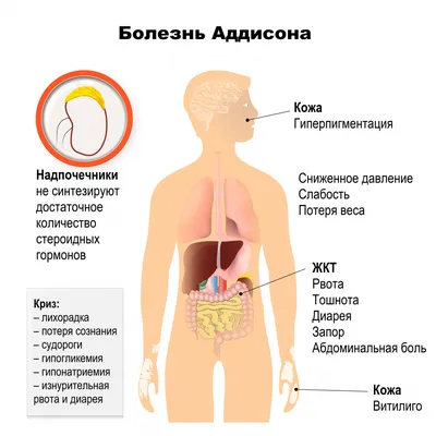 Пройти диагностику и лечение грибковых заболеваний кожи в Москве, цена