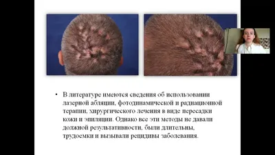 Ретинола пальмитат р-р масл. внутр 100тыс.МЕ/мл 10мл №1 с бесплатной  доставкой на дом из «ВкусВилл» | Вологда