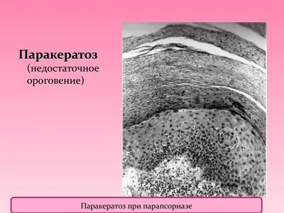 Сухая кожа: истории из жизни, советы, новости, юмор и картинки — Горячее,  страница 9 | Пикабу