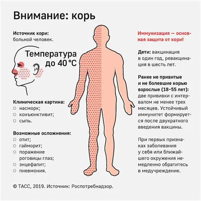 Врач рассказала о характерных симптомах кори у детей - Газета.Ru | Новости