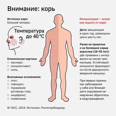 Подробно о кори – статья в блоге медицинского центра Здоровье Детям в Москве