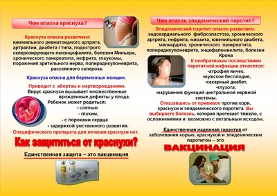 Лечение краснухи у детей в Приморском районе СПб