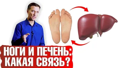 Больную печень можно распознать по этим признакам на руках | РБК Украина