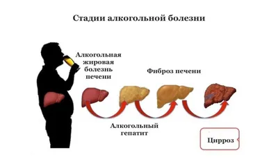 Медики рассказали, как по коже распознать «тихую» болезнь печени — Секрет  фирмы