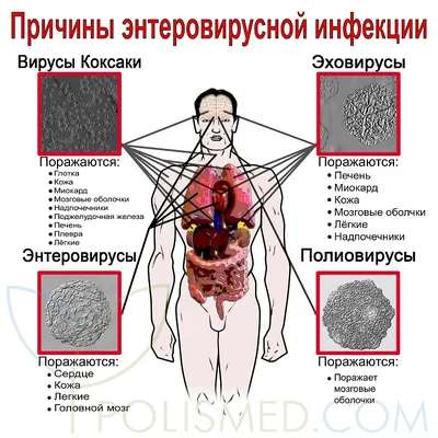Врач Тимощенко назвала неспецифические симптомы больной печени |  MedikForum.ru