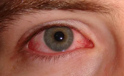 Почему могут возникать темные круги под глазами у детей: педиатр назвала  основные причины | О здоровье: с медицинского на русский | Дзен