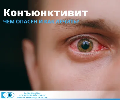 От болезни почек до аллергии: почему у ребенка синяки под глазами -  Газета.Ru
