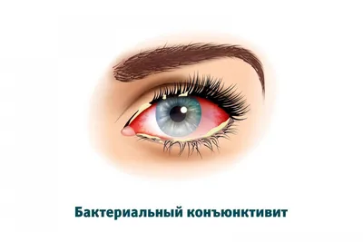 Болезни глаз у детей: распространенные проблемы и их решение - Baush + Lomb