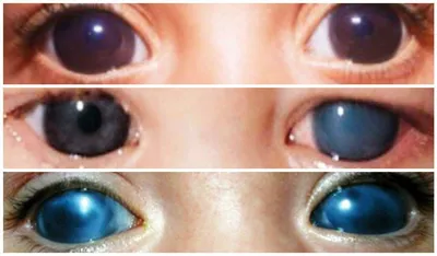 Болезни глаз симптомы - ПептидБио