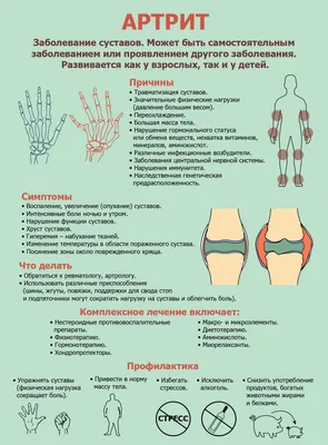 Юкка: описание, фото, уход, пересадка, размножение, виды