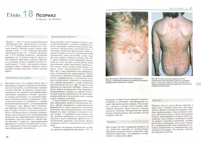 Дерматовенерология : Болезни кожи. Диагностика и лечение