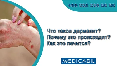 Прыщи, гнойники, болячки, болезни кожи головы | Блог IHC Clinic