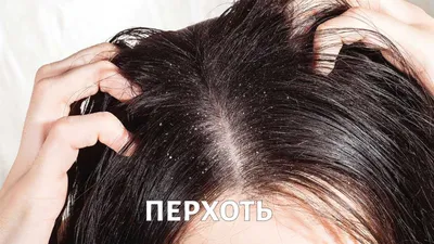 Заболевания волос у детей-Причины и лечение -Сентябрь 2022