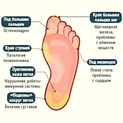 Сосудистая сетка на ногах: причины возникновения и современные методы  лечения ⋆ varicose.kiev.ua