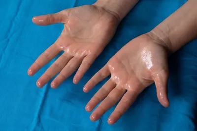 16 самых распространенных болезней кожи, про которые должен знать каждый