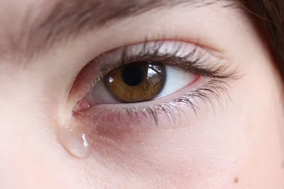 Причины врожденных болезней глаз - Офтальмологические клиники «Эксимер»  (Одесса) - диагностика и лечение заболеваний глаз у взрослых и детей