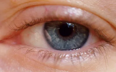 Воспаление века глаза: лечение и признаки, что делать при простуде нижнего  и верхнего века