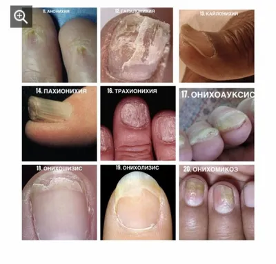 Kasya Nail Club - Хочешь более детально знать, какие болезни ногтей  существуют и что с ними делать? Скорее регистрируйся на наш вебинар Болезни  ногтей 🔥 Мы расскажем все про болезни, как работать