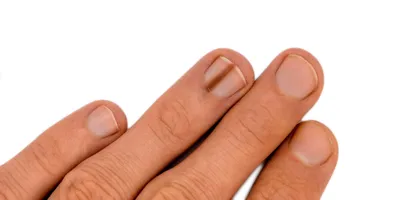 ЛэшмейкерИндастринг - ‼️Девчонки, сегодня хочу Вам немного рассказать о  ЗАБОЛЕВАНИЯХ НОГТЕЙ‼️ Здоровые ногти – это не просто красиво, но и  считается признаком здорового организма. К сожалению, с ногтями возникает  все больше проблем,