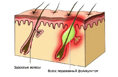 Болячка пластиковых крышек головки блока. — DRIVE2