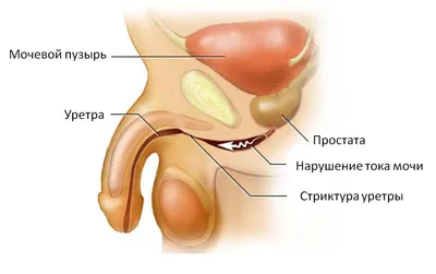 ТОП мужских заболеваний – как избежать?